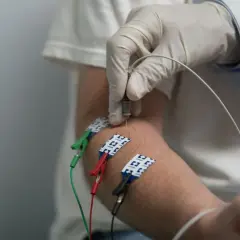 Lekarz w białej rękawiczce wykonuje badanie nerwów obwodowych, wprowadzając igłę do ramienia pacjenta. Elektrody są przymocowane do skóry.