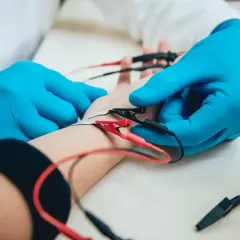 Badanie elektrofizjologiczne nerwów: elektrody podłączone do ręki pacjenta, lekarz w niebieskich rękawiczkach wykonuje pomiary.