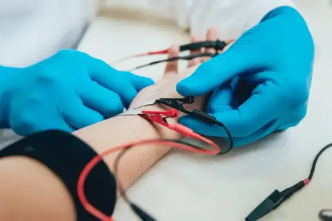 Badanie elektrofizjologiczne nerwów: elektrody podłączone do ręki pacjenta, lekarz w niebieskich rękawiczkach wykonuje pomiary.