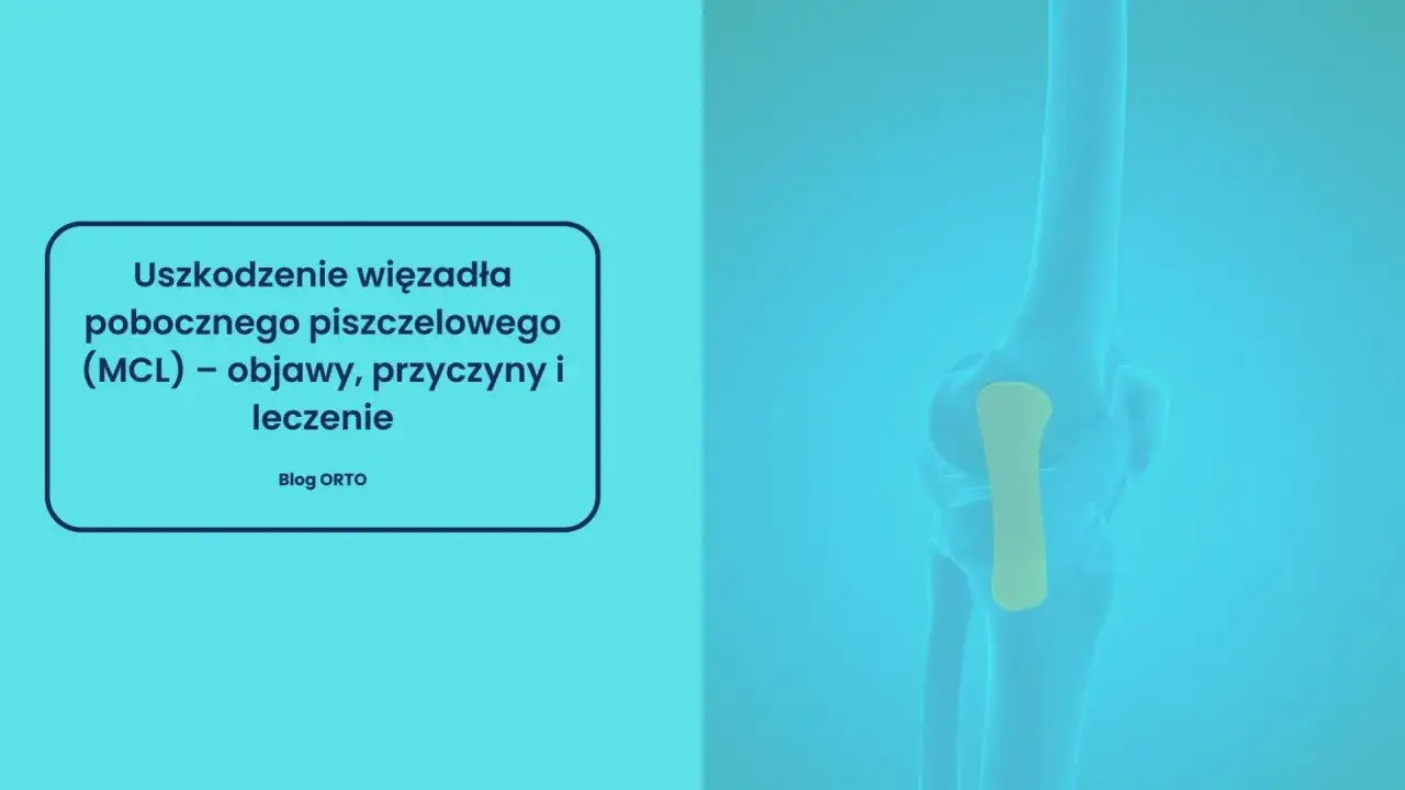Ilustracja przedstawia uszkodzenie więzadła pobocznego strzałkowego (MCL) w kolanie, z zaznaczonym żółtym obszarem.